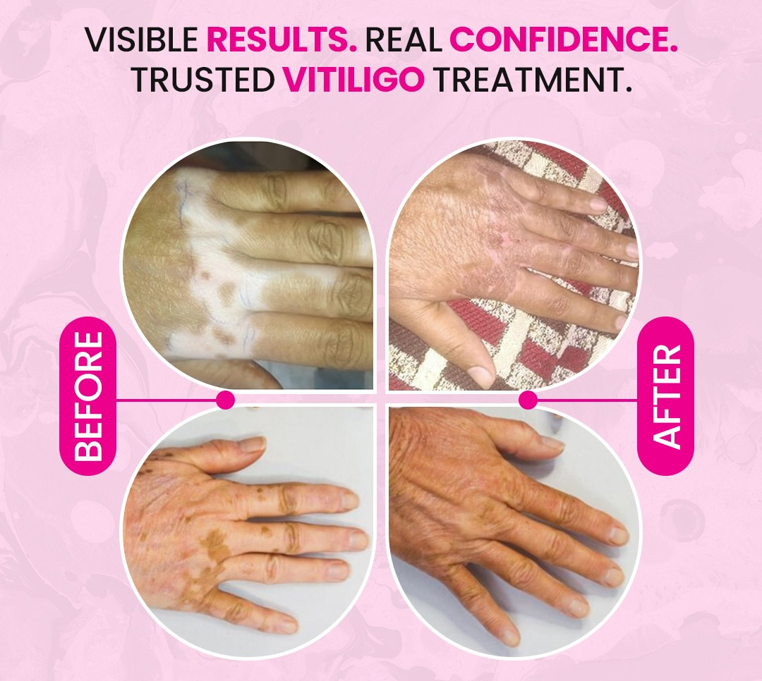 blog-post-image