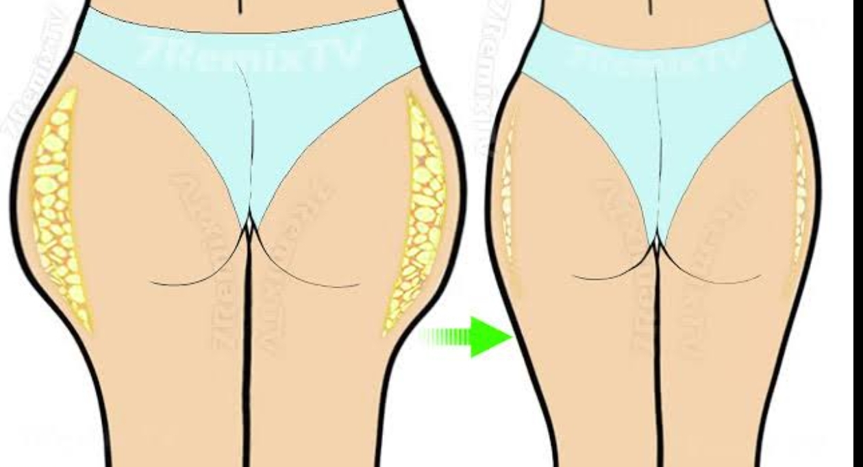 Outer thigh fat deals