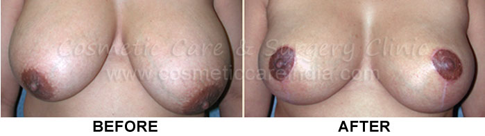 blog-post-image
